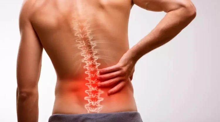 Ankylosing Spondylitis